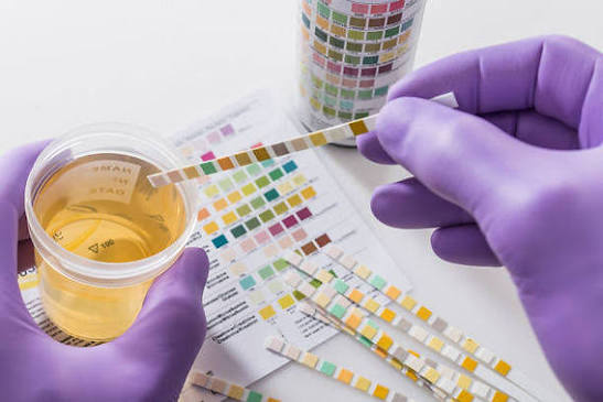 TfL Chain of Custody Drug and Alcohol Testing in London and UK