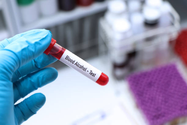 PEth Alcohol Blood Test | Fast & Accurate Testing with Results in 3 Days