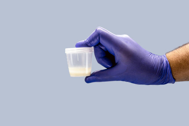 Sperm Freezing - Available in Nigeria Only